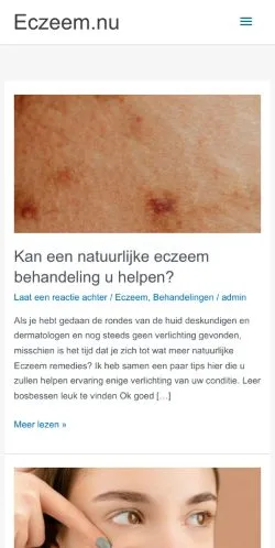 Voorbeeld van de site Eczeem, medium uit Nederland voor gesponsorde artikelen